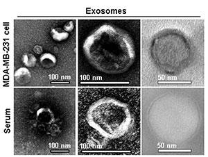 Exosomes Exosomes